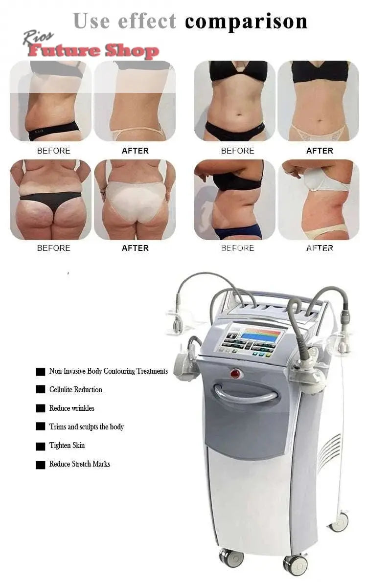 Equipment Skin Tightening Vacuum Slimming - Rios Future Shop