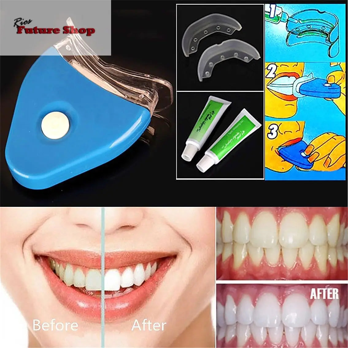 Gel Oral Dentes Clareamento Dental Clareador Clareamento Dental LED - Rios Future Shop