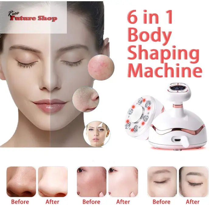 Dispositivo de beleza ultrassónico máquina, corpo de ultra - som 6 em 1 RF EMS fototerapia - Rios Future Shop