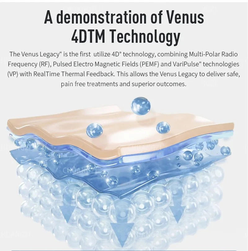 Actimel Venus Legacy Equipment DSers