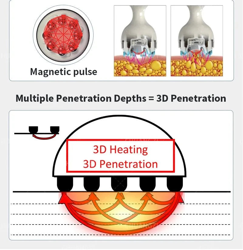 Actimel Venus Legacy Equipment DSers