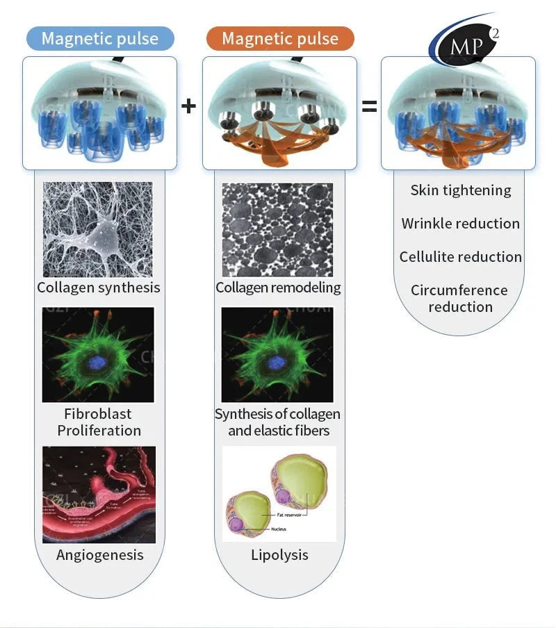 Actimel Venus Legacy Equipment DSers
