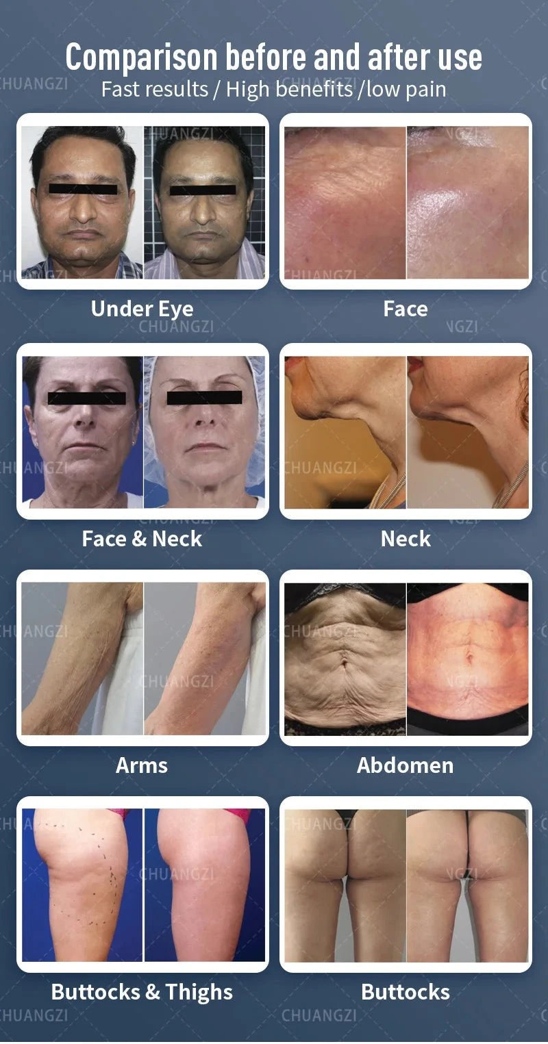 Actimel Venus Legacy Equipment DSers