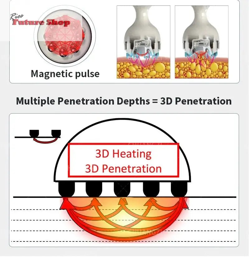 Actimel-Venus-Legacy-Equipment-Skin-Tightening-DSers-100125749 - Rios Future Shop