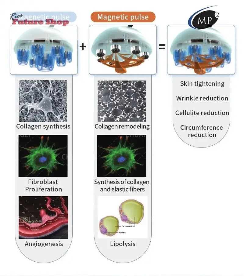 Actimel-Venus-Legacy-Equipment-Skin-Tightening-DSers-100125835 - Rios Future Shop
