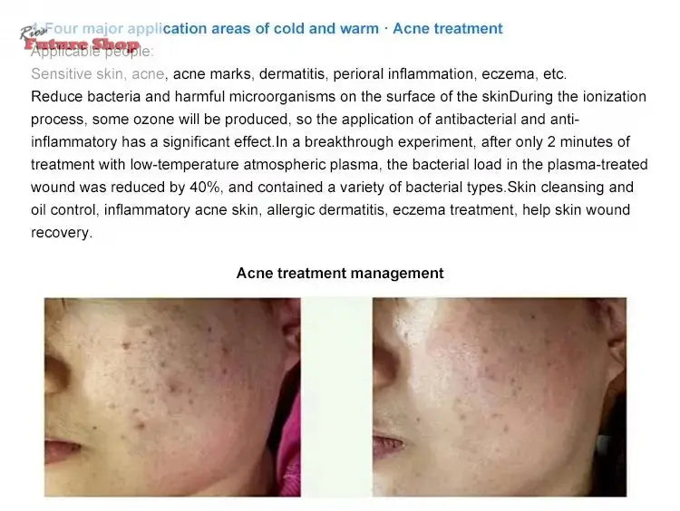 Newest 8 in 1Fusion Plasma Scalp Diamond Stamp Jet Plasma Professional Lase Fibroblast Ozone Wart Spray Pen Removal Salon - Rios Future Shop