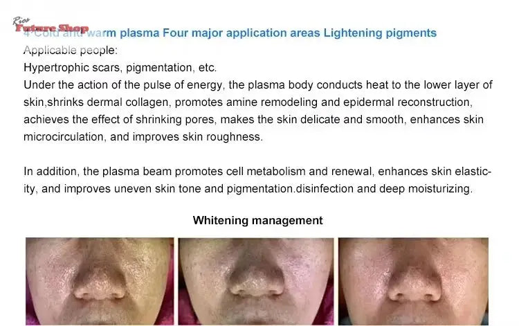 Newest 8 in 1Fusion Plasma Scalp Diamond Stamp Jet Plasma Professional Lase Fibroblast Ozone Wart Spray Pen Removal Salon - Rios Future Shop