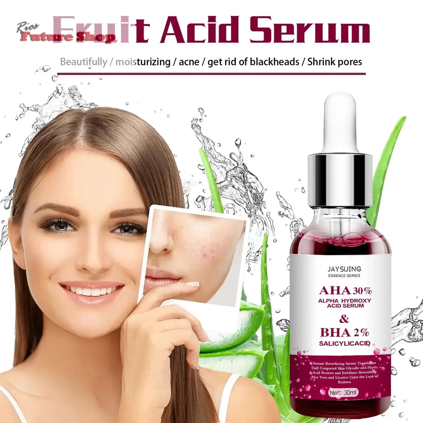 Serum anti-acné / anti-manchas - Rios Future Shop