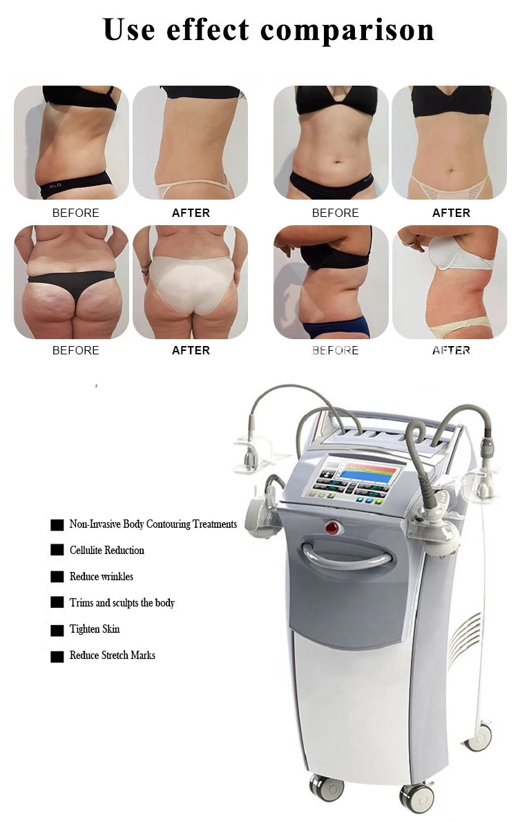 2025 Raylife Equipment Skin Tightening Vacuum Slimming Cellulite Removal Vacuum Legacy Skin Lifting Spa Device