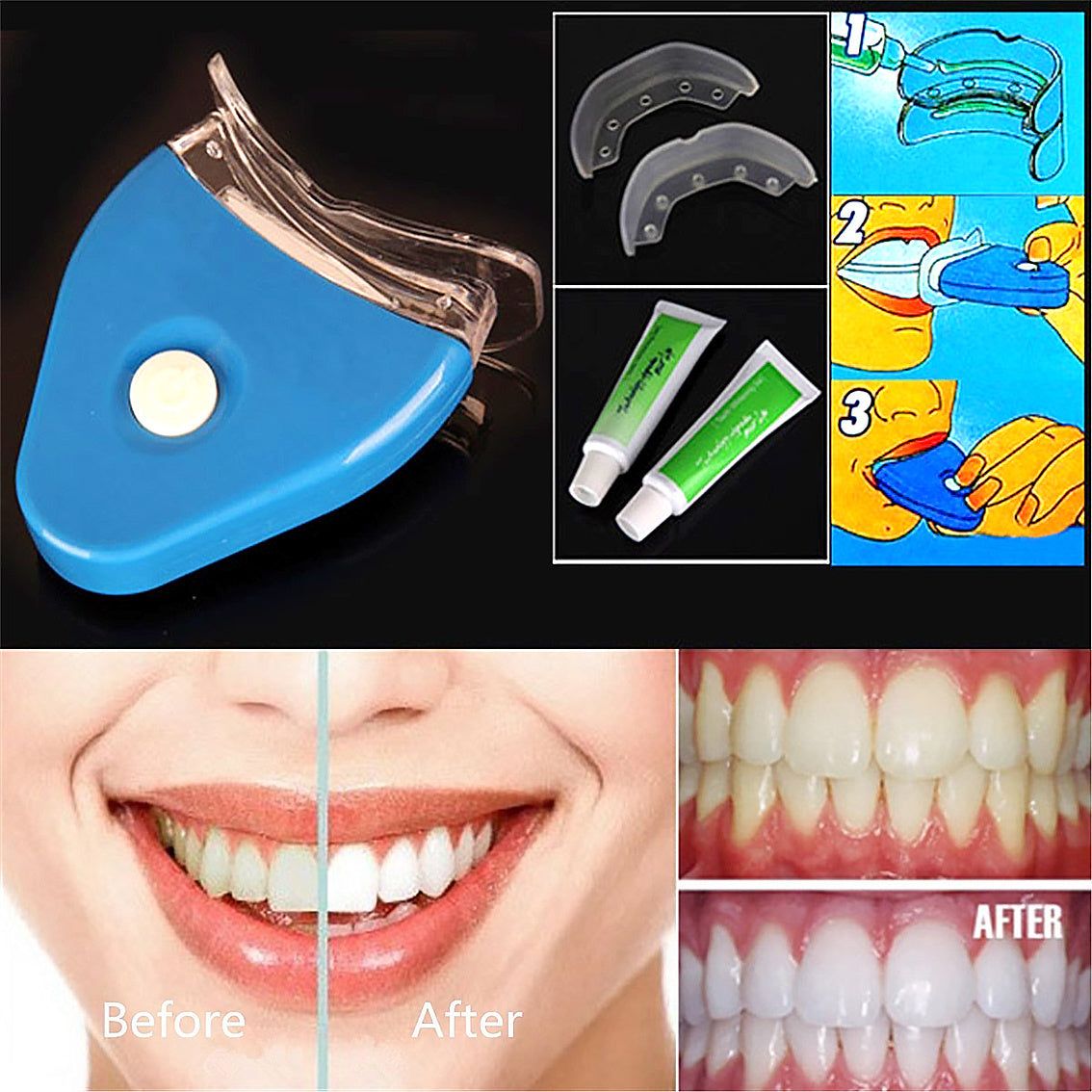 Gel Oral Dentes Clareamento Dental Clareador Clareamento Dental LED - Rios Future Shop