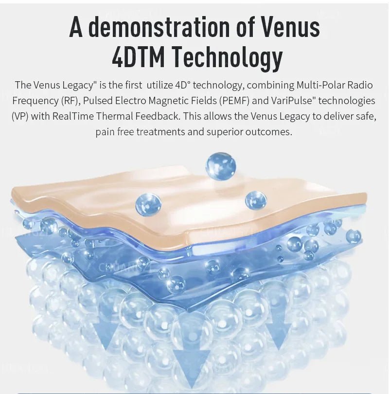 Venus Legacy Pro Skin Tightening & Vacuum Machine - Rios Future Shop